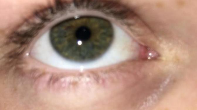 What is my true eye colour?