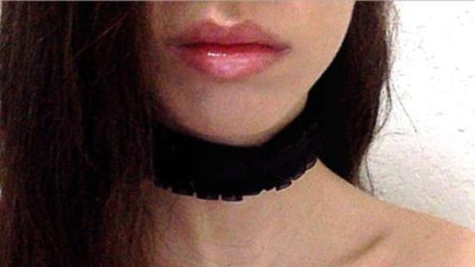 Rate my lips? (filler)?