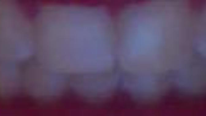 How to whiten teeth?