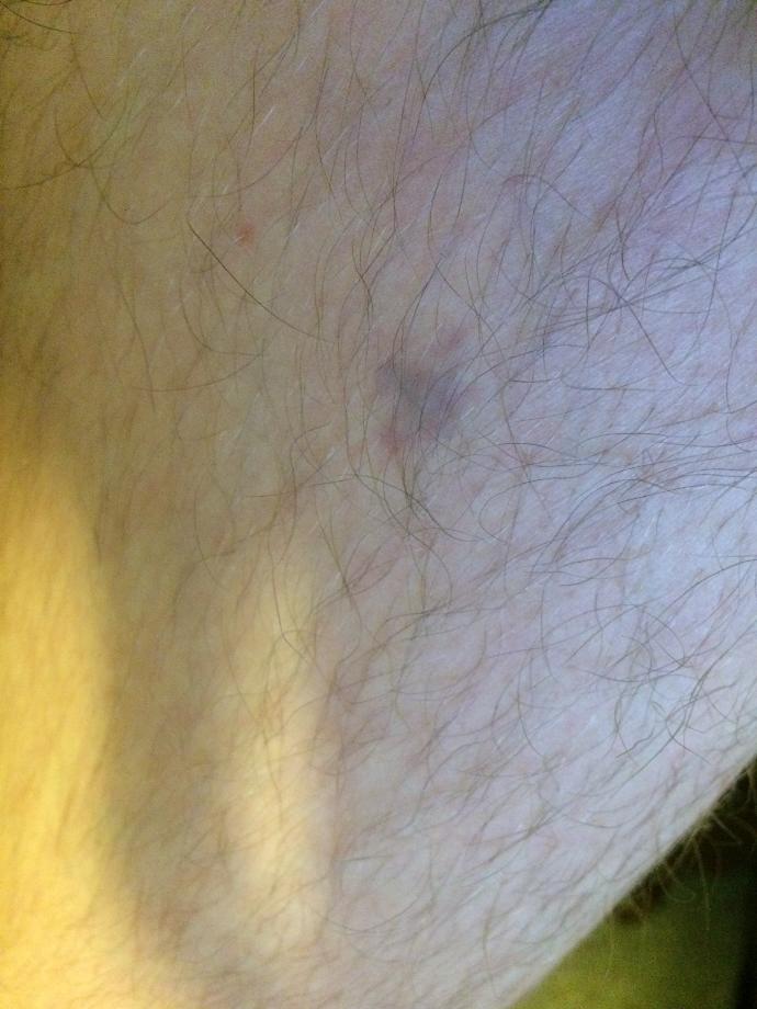 What is this spot on my leg? Should I be worried?