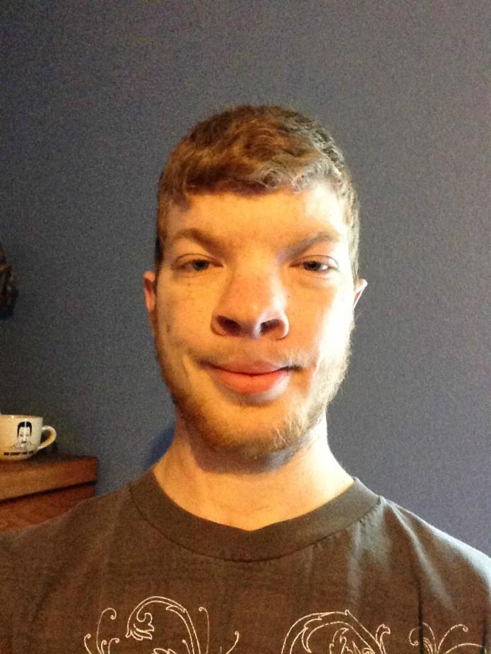 Girls, would you date this guy if he had a perfect personality? was funny, caring, nice, loyal, and a good hearted human being?