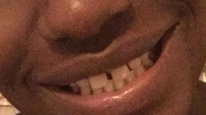 Does the gap in my teeth look bad?
