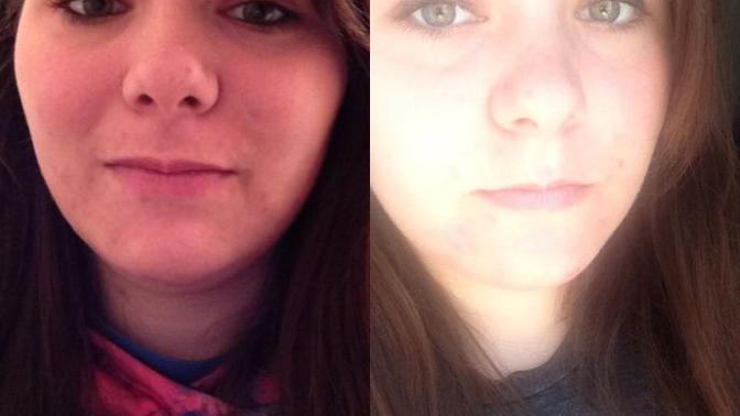 Can you see a difference in my face yet?