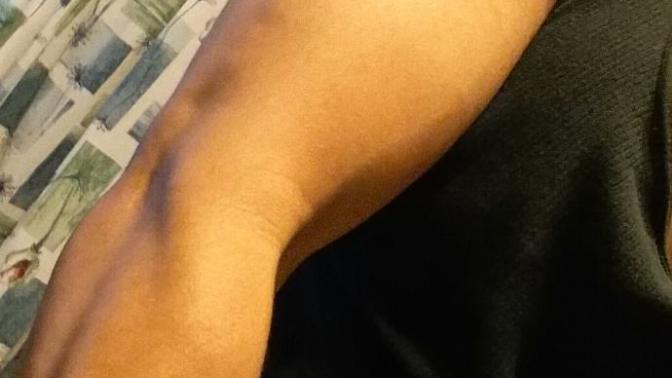 Girls, do subtle arm veins bother you or no (pics included)?