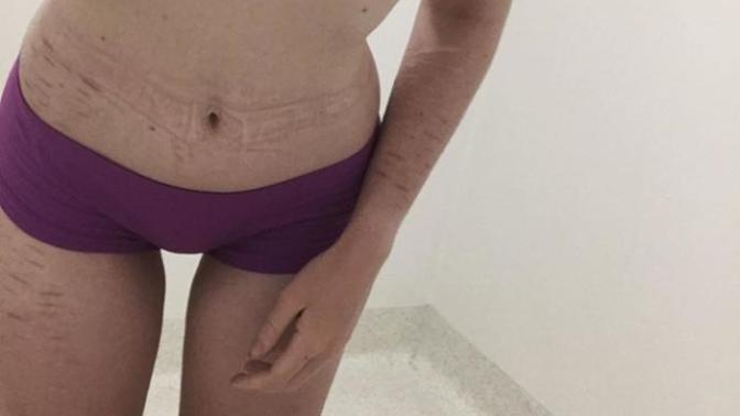 Do I Look Anorexic To You?