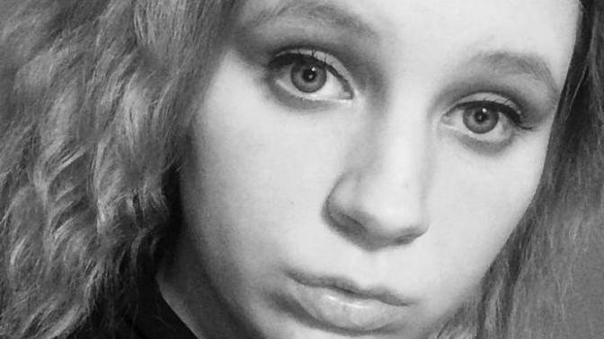 So I look better with or with out freckles?