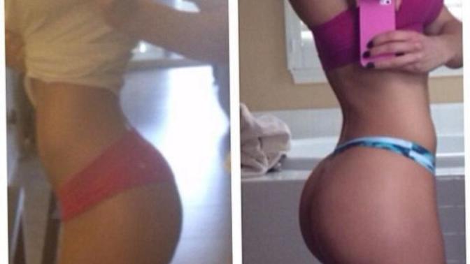 Do squats make my butt shrink? Am I the only one this happens to? 