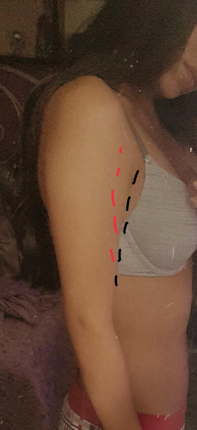 How to lose arm fat?