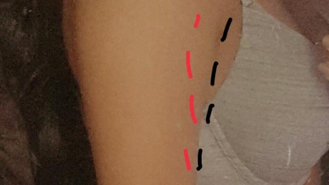 How to lose arm fat?