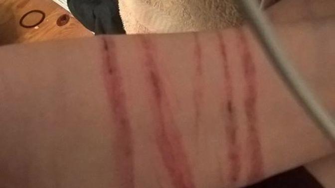 Girls, Can I hide scars like these with makeup?