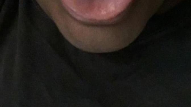 I have a tongue dimple?