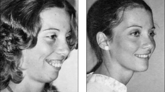 Would you marry a girl knowing she had plastic surgery to look pretty?