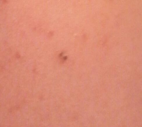 I have these weird black dots on my body, any clue on what they are?