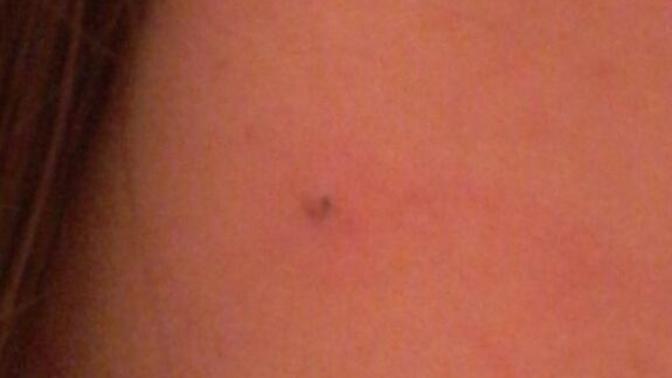 I have these weird black dots on my body, any clue on what they are?