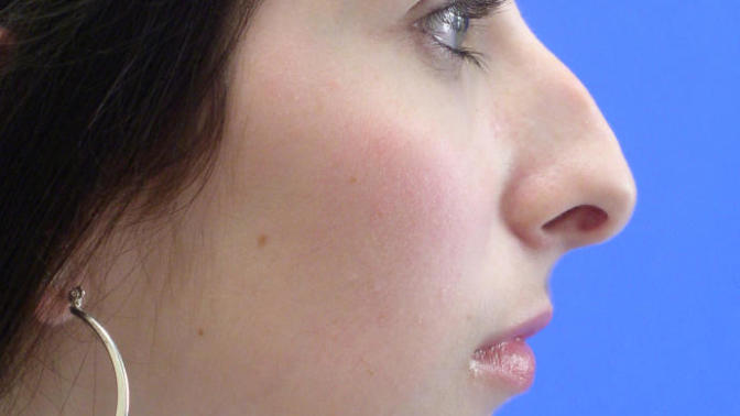 What do you think of a nose like this?