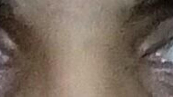 Disregard the lighting and my presently oily skin, would I be safe to assume that the shape of my eyes is similar to these?