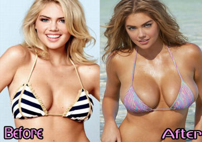 Fake Breasts Vs. Real On The Beach Fake Breasts Vs. Real On The Beach