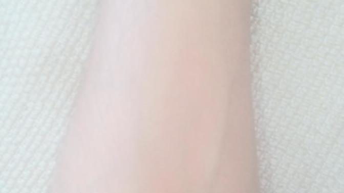 Are these green veins on arm unattractive?