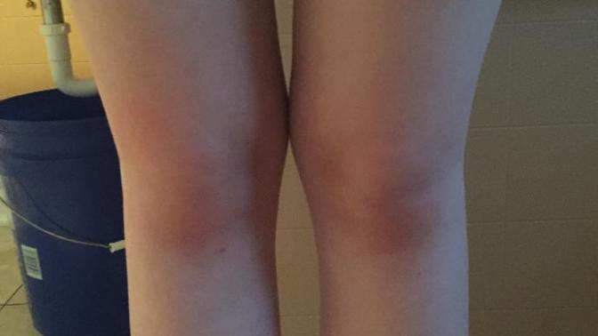 What would you recommend for me to do with my legs? Gain weight, lose weight, or how badly do I need toning?