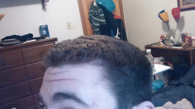 At 22 should I be concerned about my temples receding?