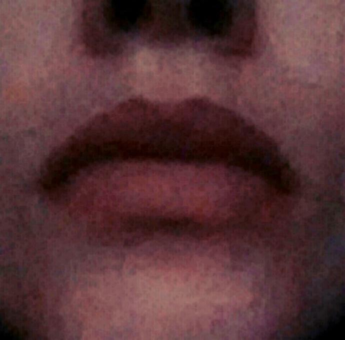 Can you please rate my lips?