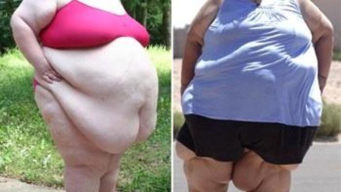 What's so bad about being fat?