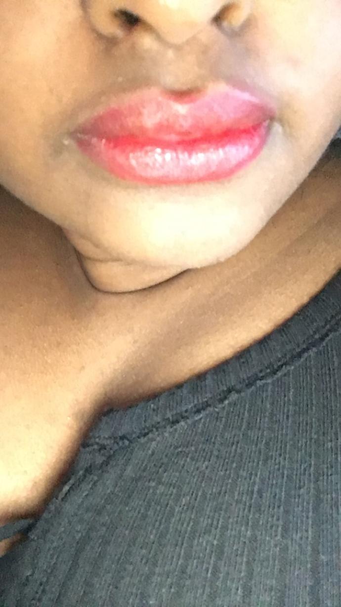 How to get rid of shadow above upper lip?