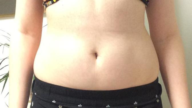 Would you consider this to be fat?