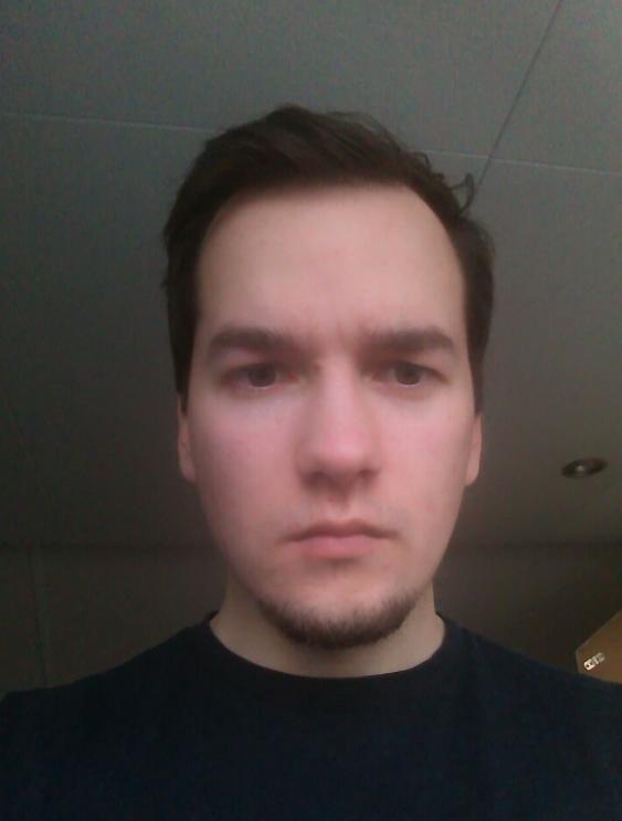 Am I balding or is it just my hairline?