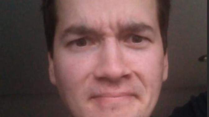 Am I balding or is it just my hairline?