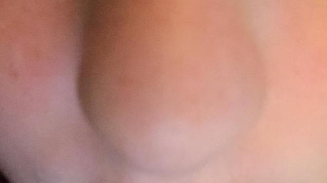 What is this hideous dot on my nose and how do I get rid of it?