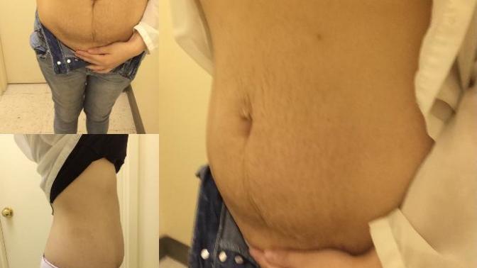 I'm afraid to lose weight?