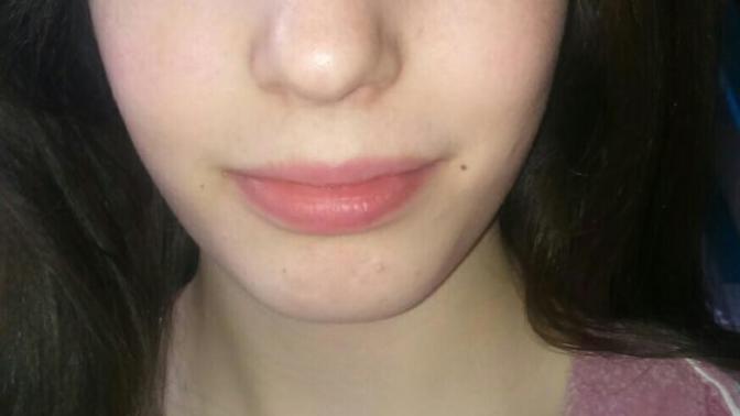 How bad is my skin?
