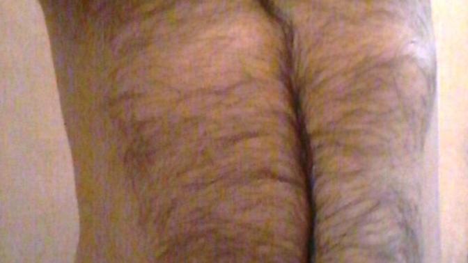Girls, How ugly my body look? suggestion? and your first thought on this?