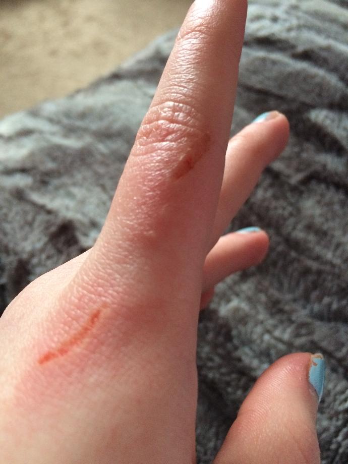 Can this be mostly healed Monday?