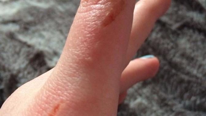 Can this be mostly healed Monday?