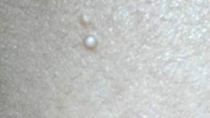 Can somebody tell me what is that on my face?