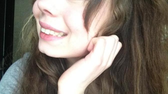 (Pictures) "Buck teeth" Cute? Ugly? Sexy?