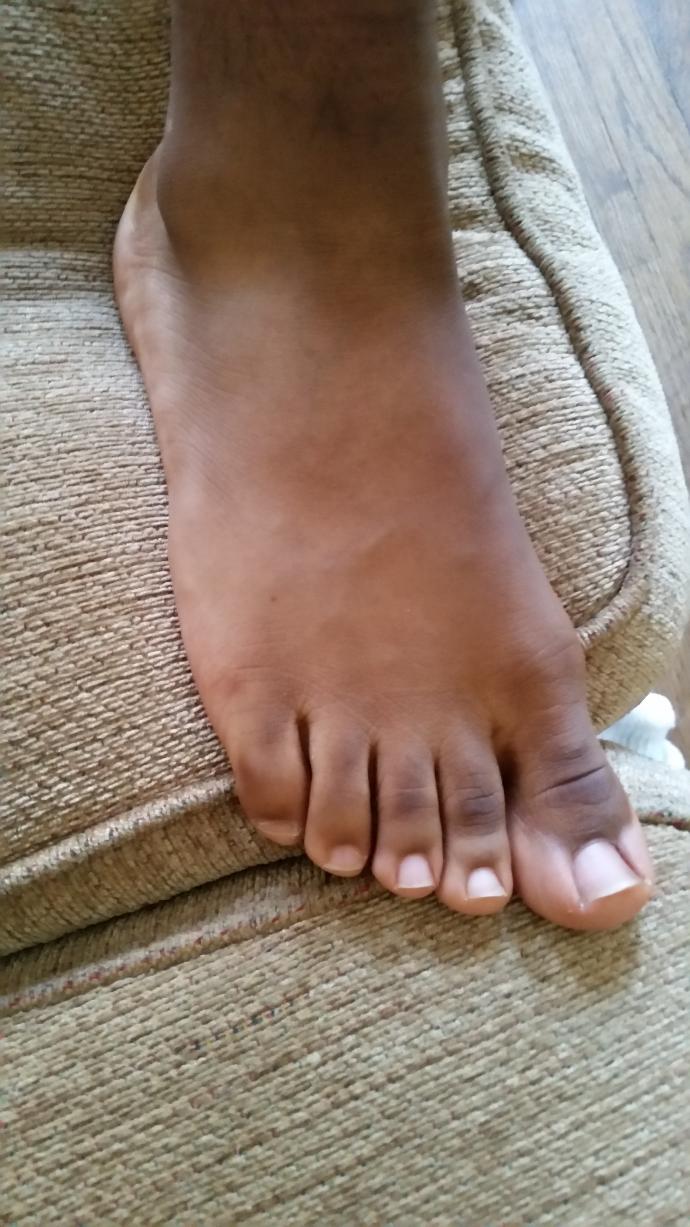 Nice male feet or ugly, what are some similarities or differences compared to how a lot of guy's feet look?