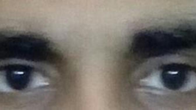 What do u think of the change in my eye area since a month back and now?