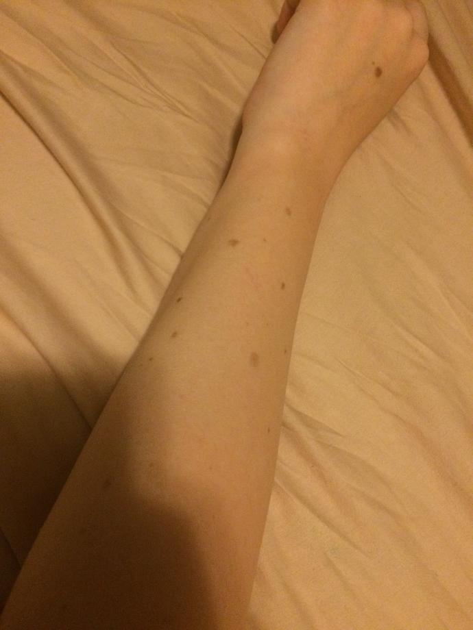 Guys, do you find moles unattractive?