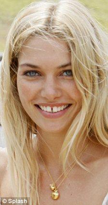 Thoughts on gap tooth & yaeba teeth?