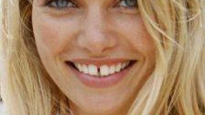 Thoughts on gap tooth & yaeba teeth?