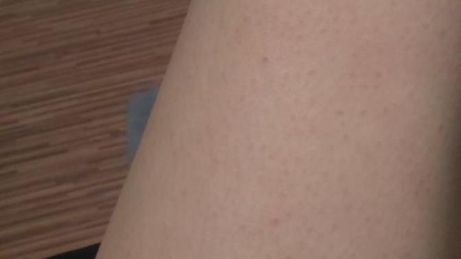 Why is my leg skin like that?