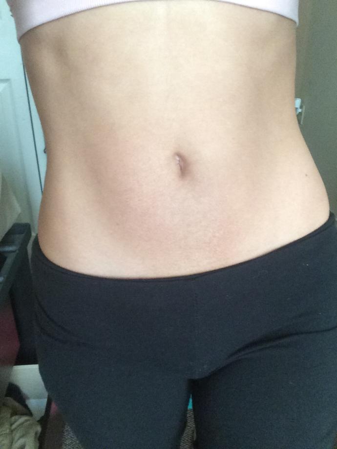Does anyone know of any good cream for dark spots removal on skin?