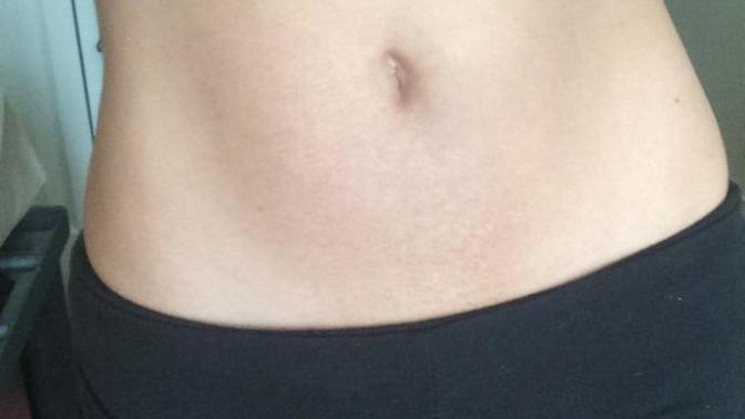Does anyone know of any good cream for dark spots removal on skin?