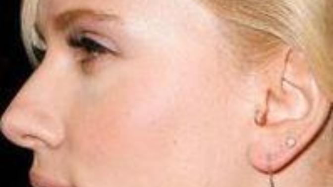 Which celebrity has the sexiest nose?
