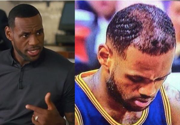 Are you between 18-35 years old and going bald?