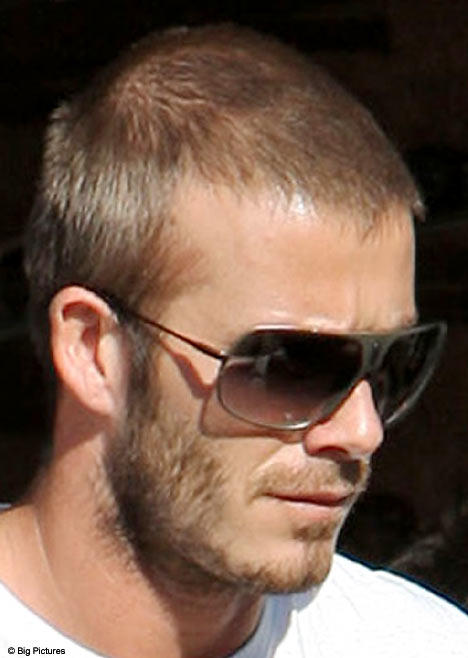 Are you between 18-35 years old and going bald? 