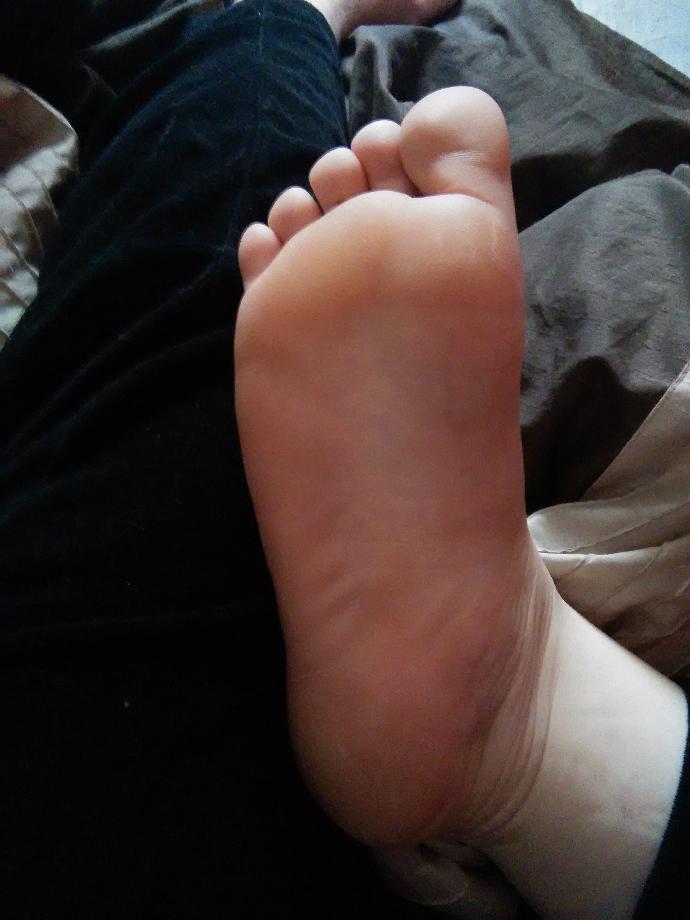 What colour should the bottom of a person's foot be?